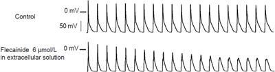 The Antiarrhythmic Mechanisms of Flecainide in Catecholaminergic Polymorphic Ventricular Tachycardia